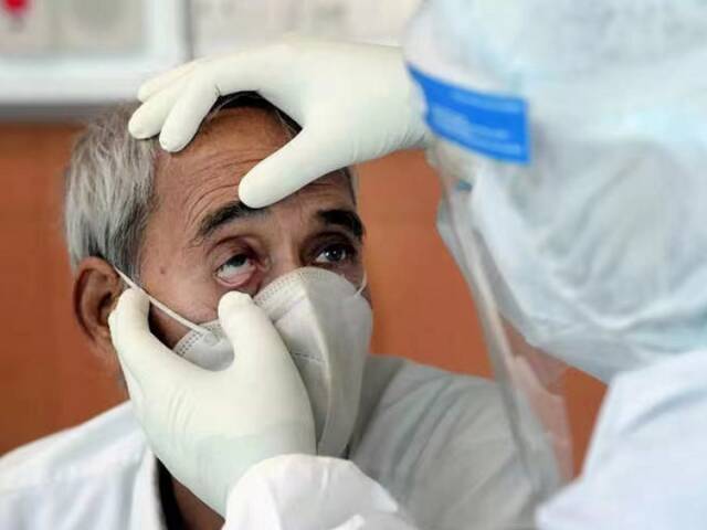 △医生对毛霉菌病患者进行检查（图片来源：《印度时报》）