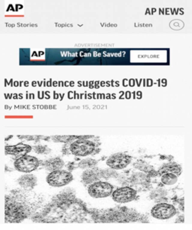 △美联社报道称，越来越多证据表明，新冠病毒早在2019年12月就已经在美国开始传播