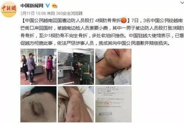 2017年2月7日，三名中国游客从越南芒街回国时，被越南边检人员索要“小费”，其中一人被打骨折图：中新网微博截屏