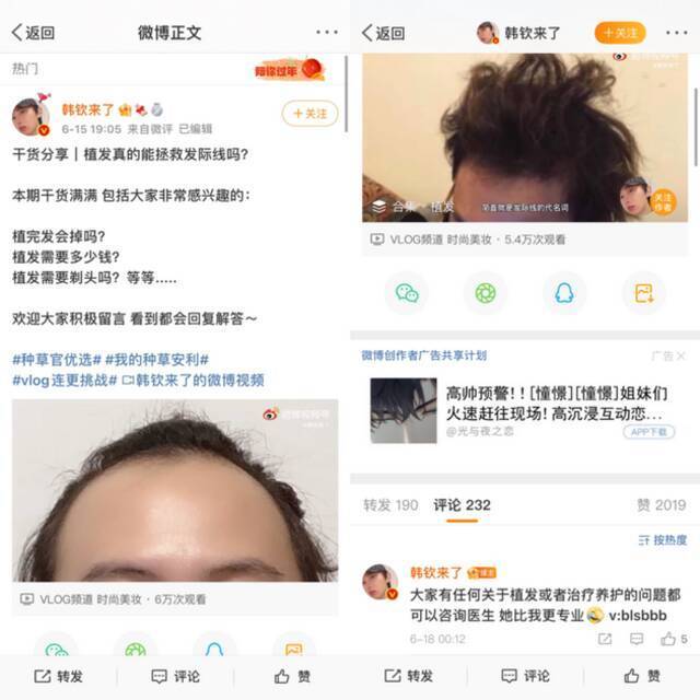 植发火热的背后：广告费用上亿，行业乱象频现