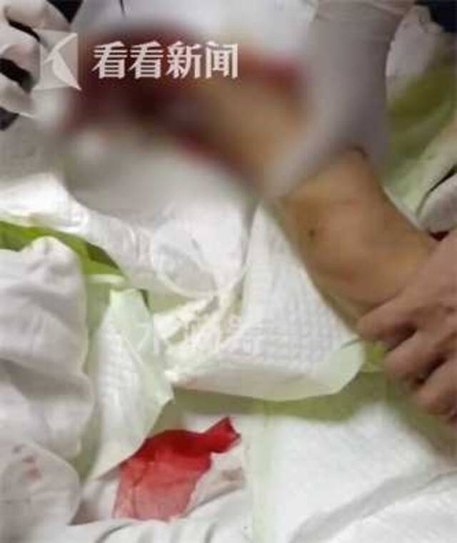 视频｜无牌无证铲车冲进家里，为救孙子爷爷不幸身亡