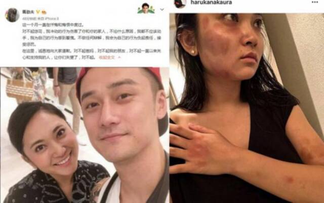 ·蒋劲夫前女友中浦悠花晒出被家暴的照片（右图），蒋劲夫不久后在微博发文道歉（左图）。