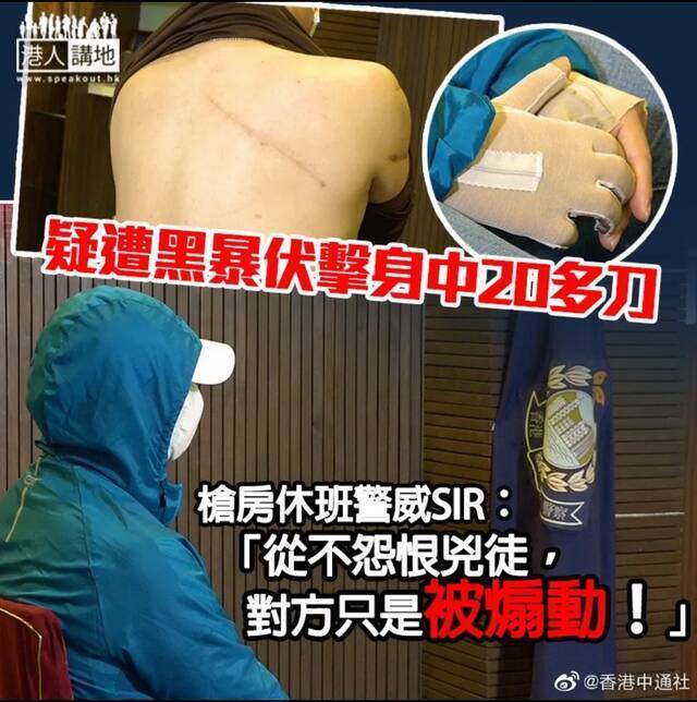 “香港警察大威”在文章中发布的港媒关于自己受伤的报道截图