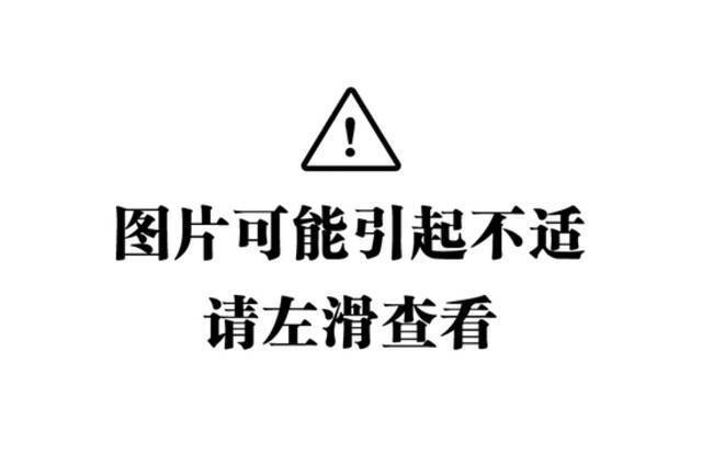 被土耳其认定为“毒品”的槟榔 为何在我国还能每年狂卖百亿？