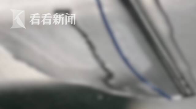 为了滋补生吞蛇胆！男子说话结巴 颅内取出活虫