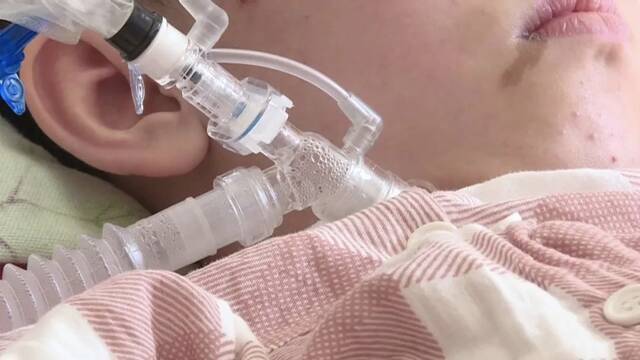 14岁女孩靠呼吸机维持生命 刚拿到手的救命钱却被骗光