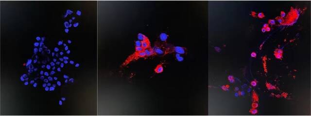 免疫荧光图像检测变种病毒的NP蛋白，未感染组（左）和48小时感染组（中、右）图片来自央视新闻