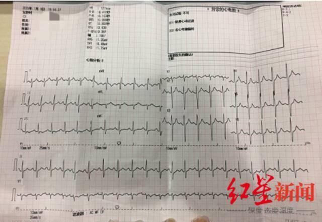 事发当天，白女士去医院检查的心电图结果