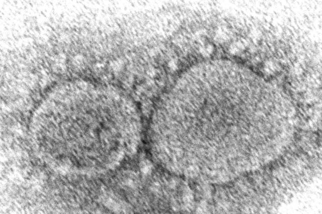 美国疾病控制与预防中心提供的电子显微镜图像显示了导致新冠肺炎的SARS-CoV-2病毒颗粒美联社资料图