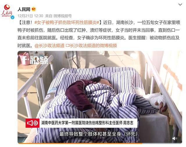 洗虾被刺可能会被截肢？既不是耸人听闻 也不用过度担心