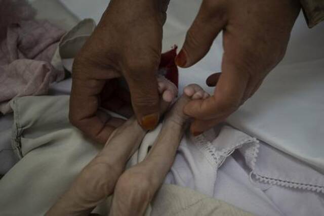 喀布尔医院营养不良的婴儿