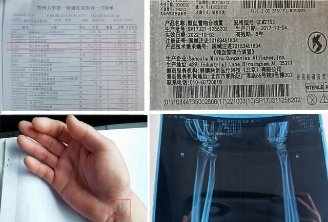 患者关涛的收费清单中显示有吻合器一项、拍摄的X光片中却未见，此外还有其使用的吻合器合格证。新京报记者程亚龙摄