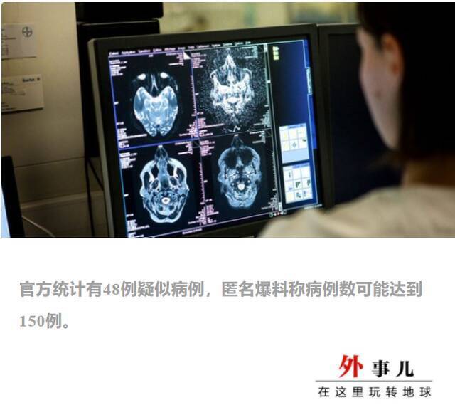 加拿大不明疾病蔓延，患者出现痴呆、幻觉等症状