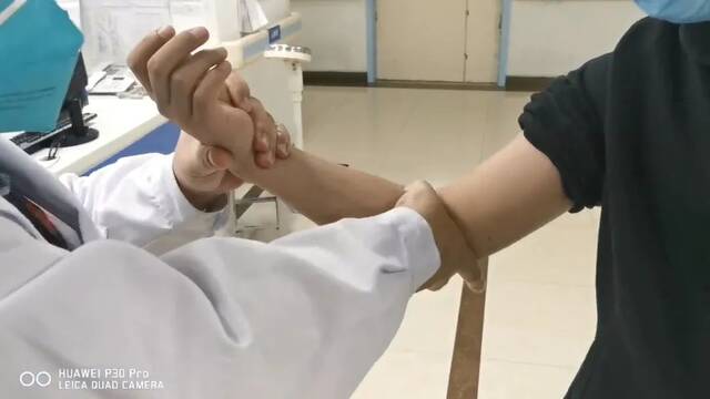 西安红会医院郑江医生为患者录制的手法复位示范视频截图。受访者供图