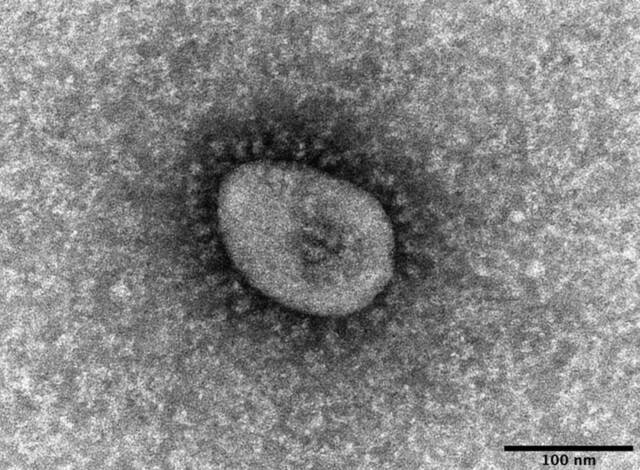 电子显微镜下的奥密克戎毒株（图片来源：共同社）