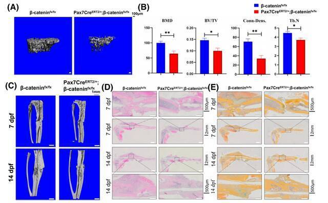 图2特异性敲除骨骼肌卫星细胞中的β-catenin导致小鼠骨量丢失和骨折愈合延迟
