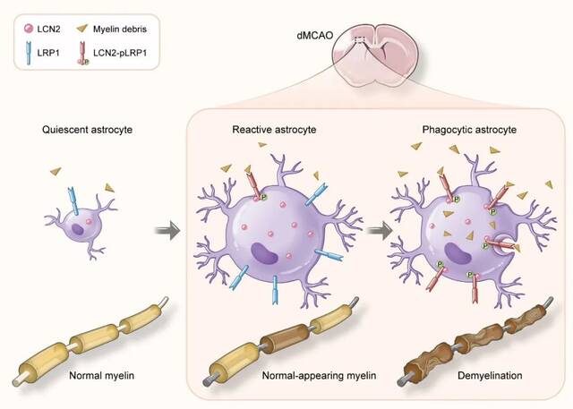 小鼠非缺血区胼胝体星形细胞吞噬作用参与继发性脱髓鞘机制图