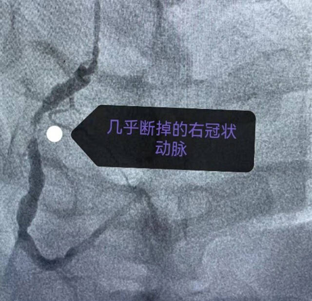 患者李先生影像检查报告本文图均为上海新华医院供图