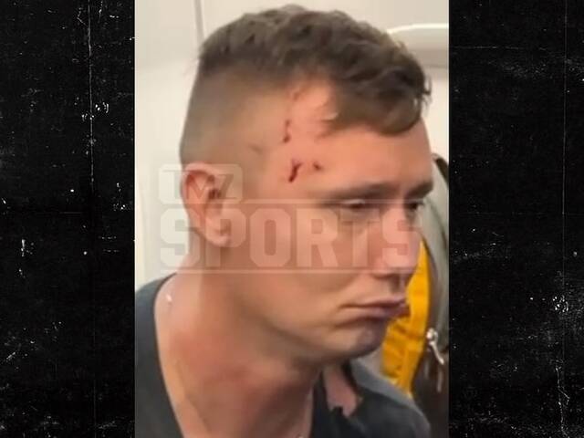 被打男子脸部受伤（美国在线旗下网站“TMZ”）