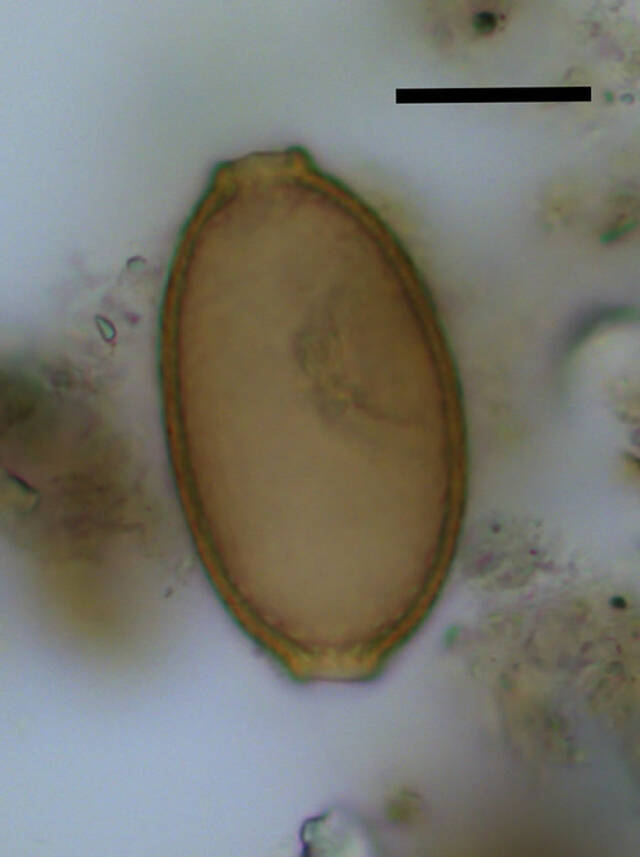 巨石阵附近发现的4500年前古代粪便中的寄生虫揭示史前饮食的秘密