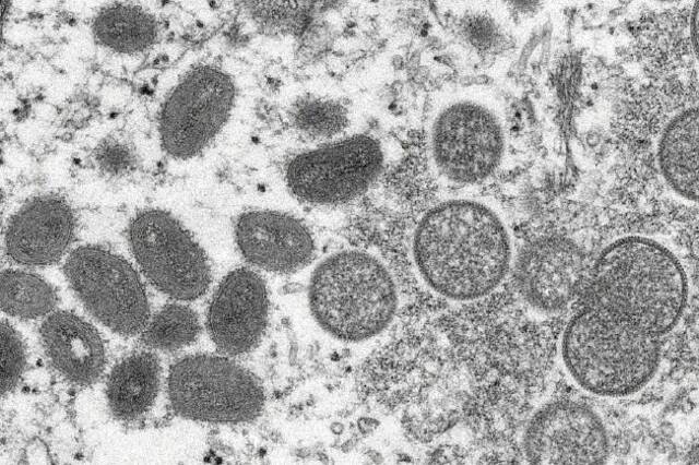 成熟猴痘病毒（左）和未成熟病毒粒子（右）电子显微镜图像