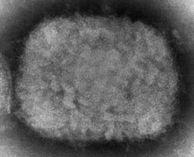 猴痘病毒电子显微镜图像（资料图）