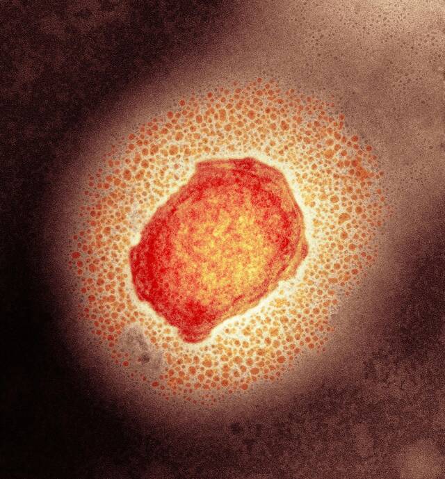 彩色透射电子显微镜（TEM）下的猴痘病毒。图/IC photo