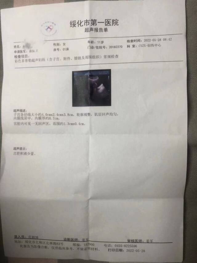 黑龙江一小学女生遭多名男生殴打，家属：校方已承担相应费用，打人男生将被处分