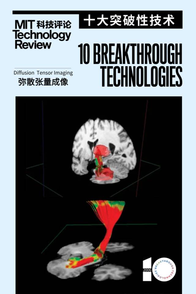 “DTI让我们能够以前所未有的方式检视大脑。”