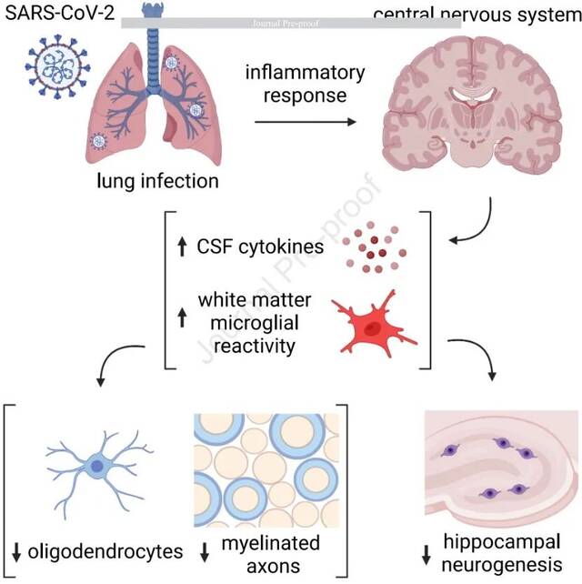 斯坦福、耶鲁研究：新冠感染轻症仍可能导致神经细胞和髓鞘失调