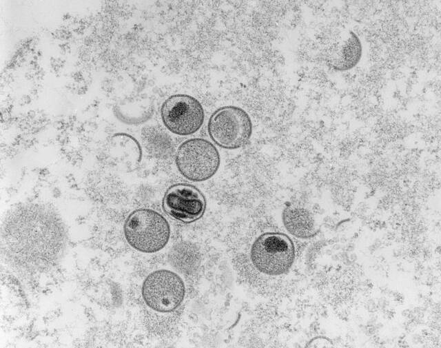 显微镜下的猴痘病毒。（资料图）