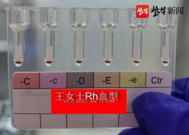 江苏泰州发现2例全球罕见“黄金血型”