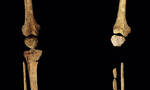已知最早的截肢手术：印尼婆罗洲洞穴挖掘出3.1万年前左小腿被切除的人类遗骸化石