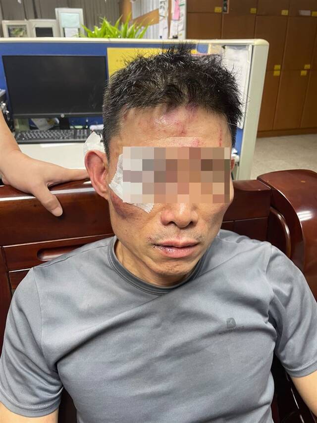 被警察误当通缉犯打伤，台男子：对方未出示证件表明来意，直接就打