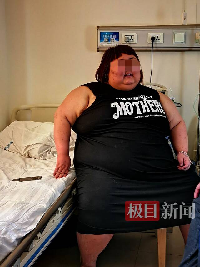 443斤女子住院切胃想减肥至200斤，小学时一顿能吃5个馒头
