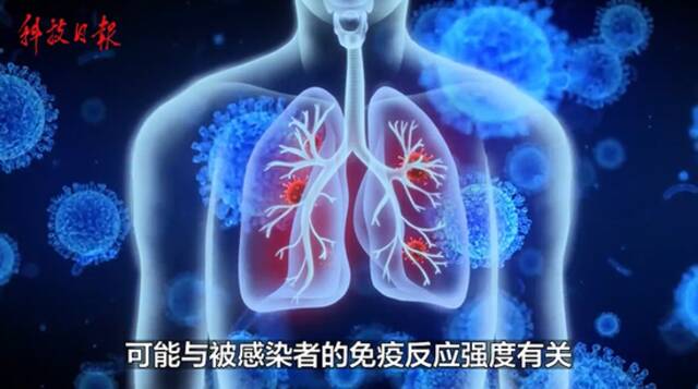 新冠研究：抗体水平较高的人更会失去嗅觉或味觉