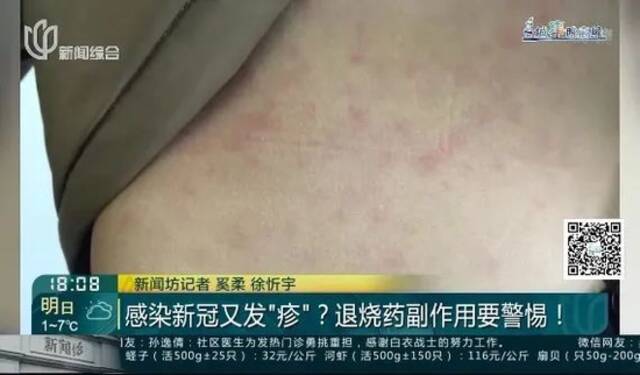 感染新冠两周后心肌会有反应！“阳”后又有新症状，“惨不忍睹”，不少人中招……