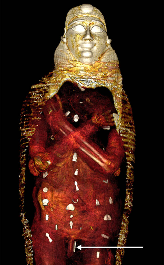 CT扫描显示：“金童”木乃伊受到49个珍贵护身符的保护