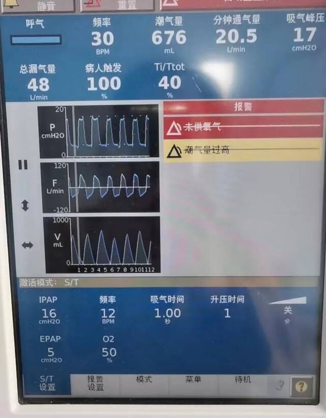 2022年12月30日，张淼父亲的呼吸机参数。受访者供图