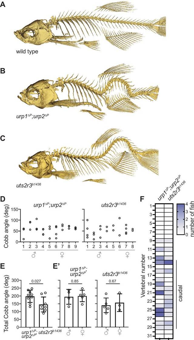 斑马鱼的研究有助于揭示脊柱侧弯的起源