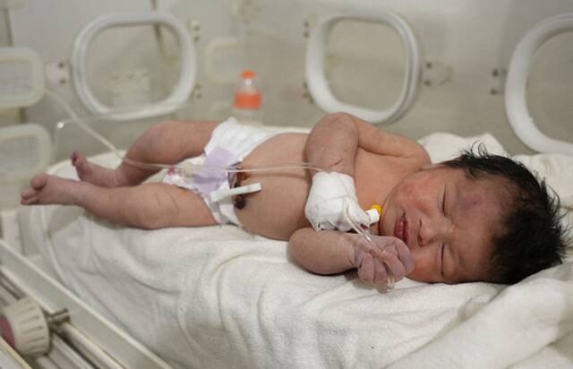 从地震废墟下获救的女婴在医院接受治疗