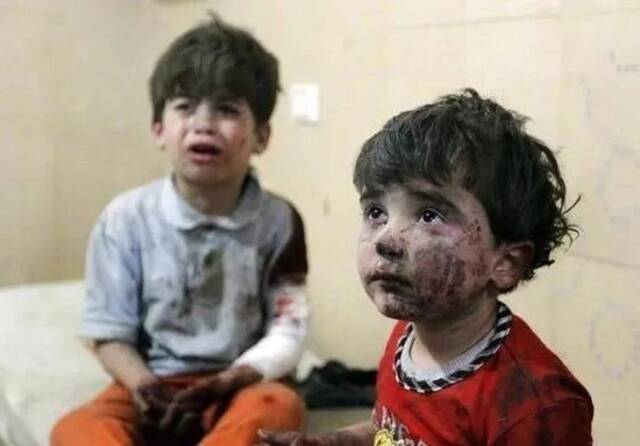 ·2014年5月，叙利亚阿勒颇附近，在轰炸中受伤的孩子在哭泣。