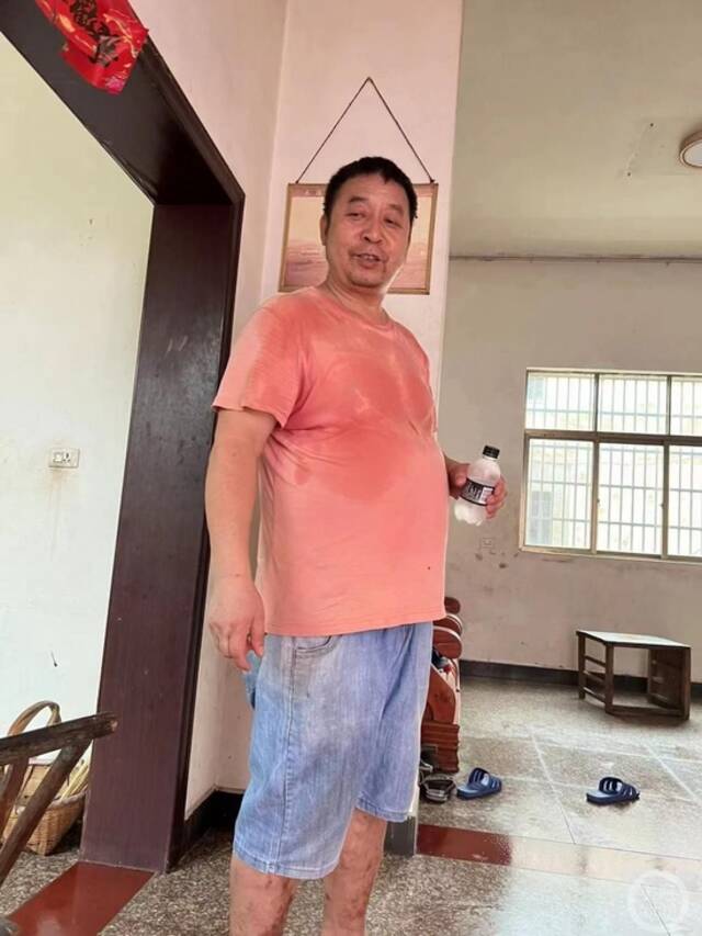 ▲54岁的胡荣梁在新干县中医医院手术后44小时死亡。图片来源/受访者供图