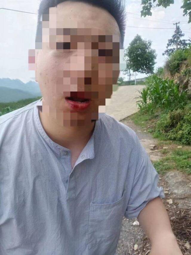 记者回应毕节采访教师溺亡遭殴打：已通过照片辨认嫌疑人