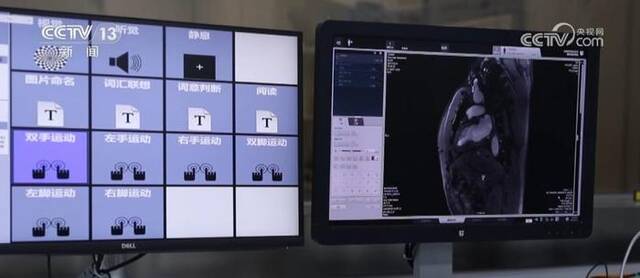 国产核磁共振仪量产 科研“精准施力”产研融合摘得“明珠”