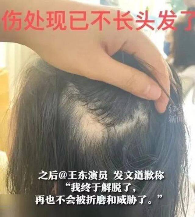 演员夫妇和好，女方曾称被丈夫拳打脚踢，头部受重伤，被公公开车撞！