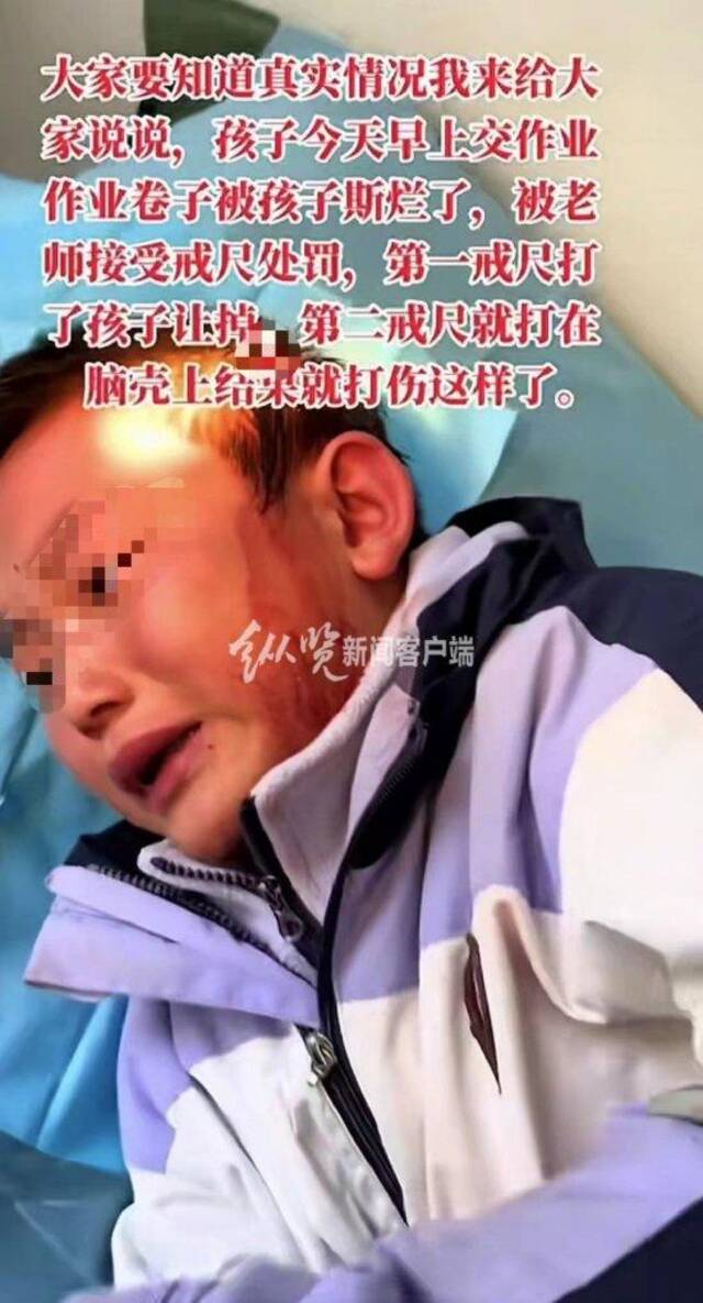 孩子头部伤口鼓包流血。（来源/视频截图）