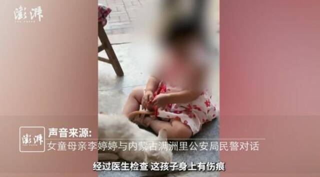 2岁女童送医后死亡，其父承认“时常殴打孩子”已被刑拘