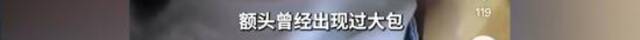 2岁女童送医后死亡，其父承认“时常殴打孩子”已被刑拘