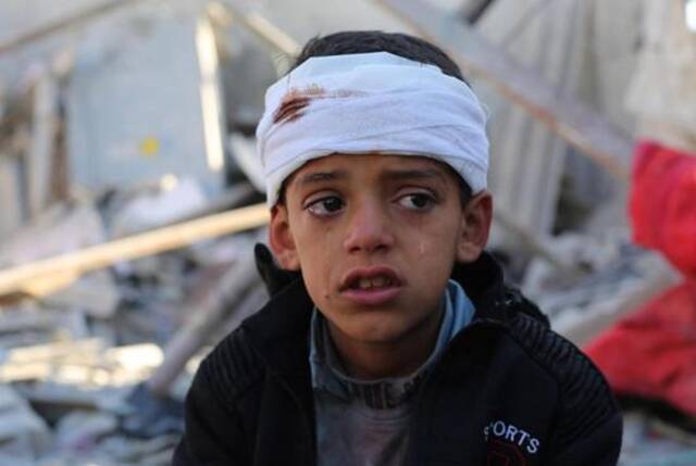 1月18日，在加沙地带南部城市拉法，一名受伤的男孩在哭泣图：新华社